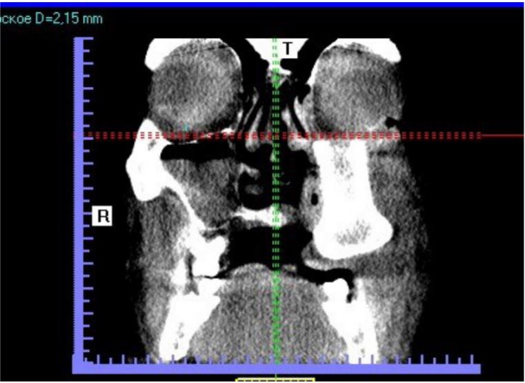 Figure 9.JPG